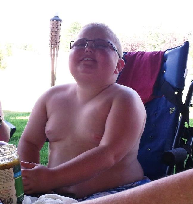 Hookup A Man With Muscular Dystrophy Hookup A Man With Muscular Dystrophy